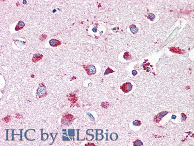 Polyclonal Antibody to Hexosaminidase B Beta (HEXb)