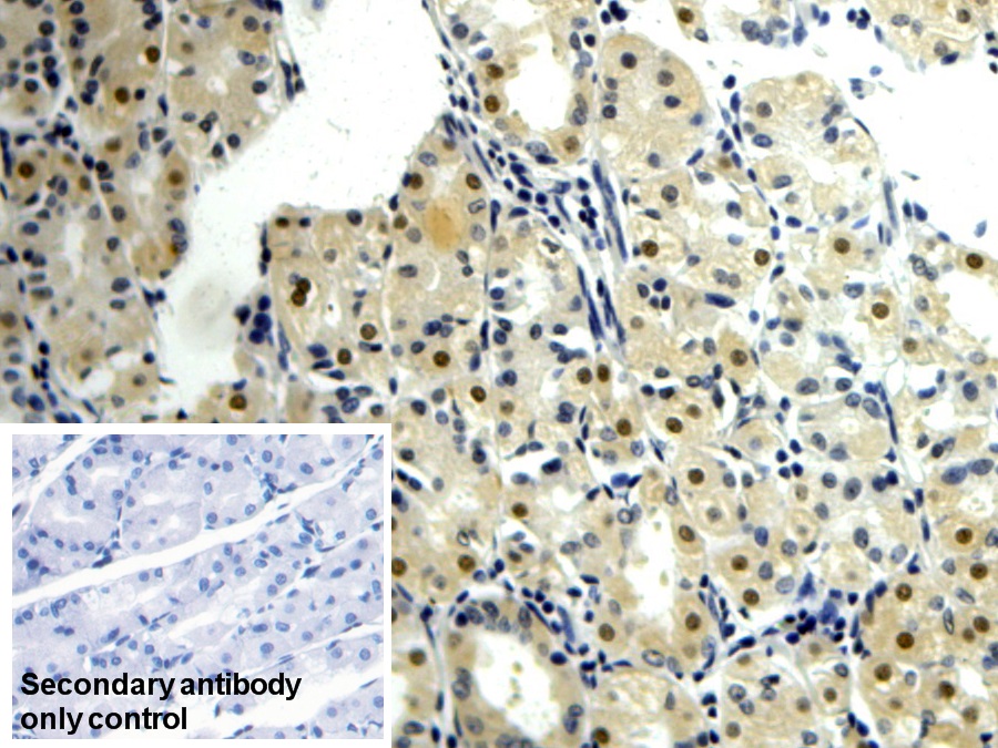 Polyclonal Antibody to Visfatin (VF)