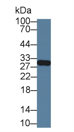 Polyclonal Antibody to Glutathione S Transferase Mu 4 (GSTm4)