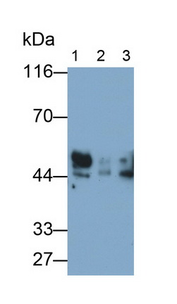 Polyclonal Antibody to Receptor For Advanced Glycation Endproducts (RAGE)