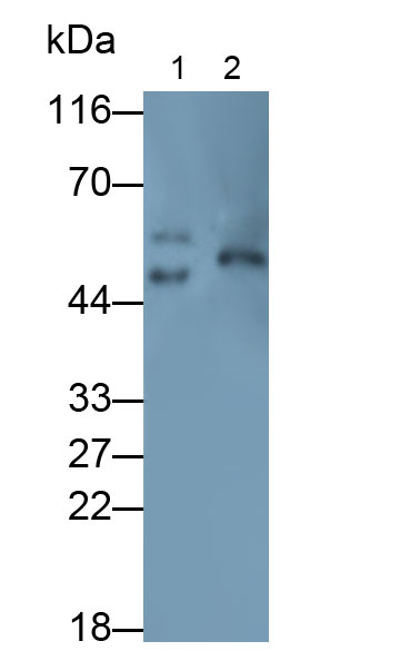 Polyclonal Antibody to Receptor For Advanced Glycation Endproducts (RAGE)