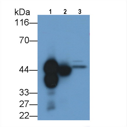 Polyclonal Antibody to Receptor For Advanced Glycation Endproducts (RAGE)