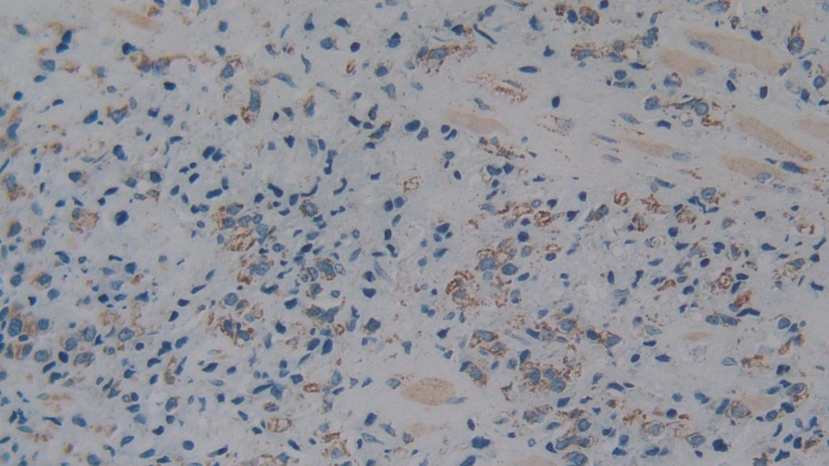 Polyclonal Antibody to Complement component 1 Q subcomponent-binding protein, mitochondrial (C1QBP)