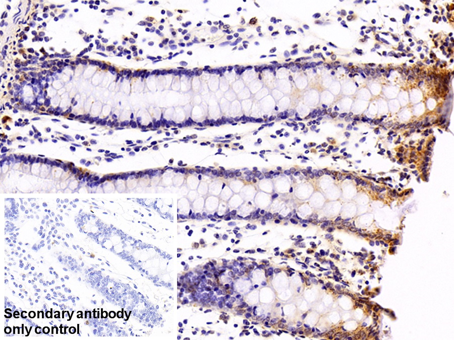 Polyclonal Antibody to Complement component 1 Q subcomponent-binding protein, mitochondrial (C1QBP)