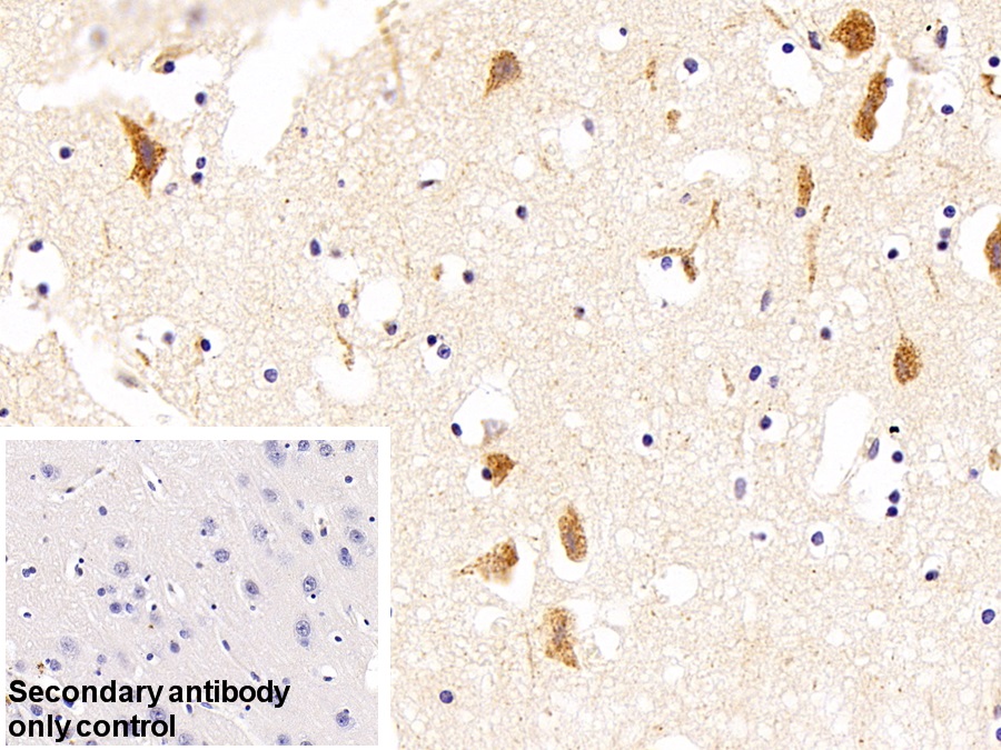 Polyclonal Antibody to Complement component 1 Q subcomponent-binding protein, mitochondrial (C1QBP)