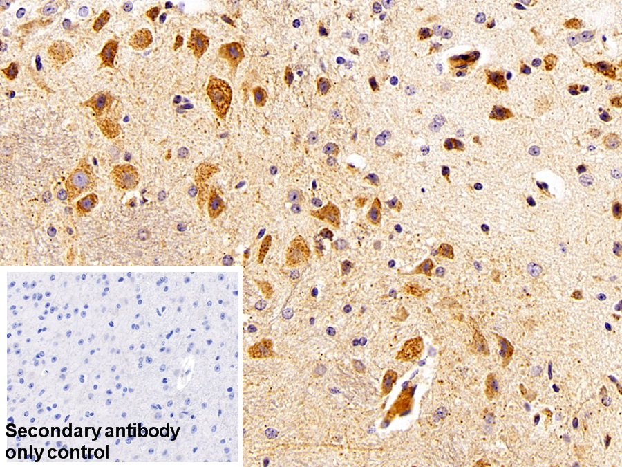 Polyclonal Antibody to Complement component 1 Q subcomponent-binding protein, mitochondrial (C1QBP)