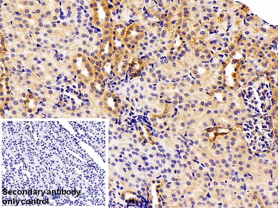 Polyclonal Antibody to Complement component 1 Q subcomponent-binding protein, mitochondrial (C1QBP)