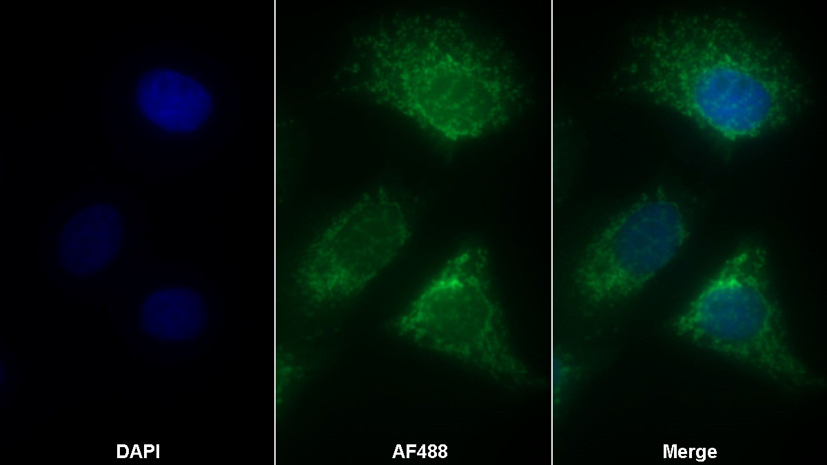 Polyclonal Antibody to Complement component 1 Q subcomponent-binding protein, mitochondrial (C1QBP)