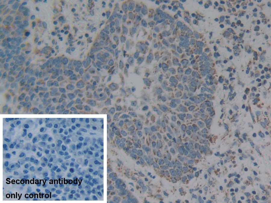 Polyclonal Antibody to Complement component 1 Q subcomponent-binding protein, mitochondrial (C1QBP)