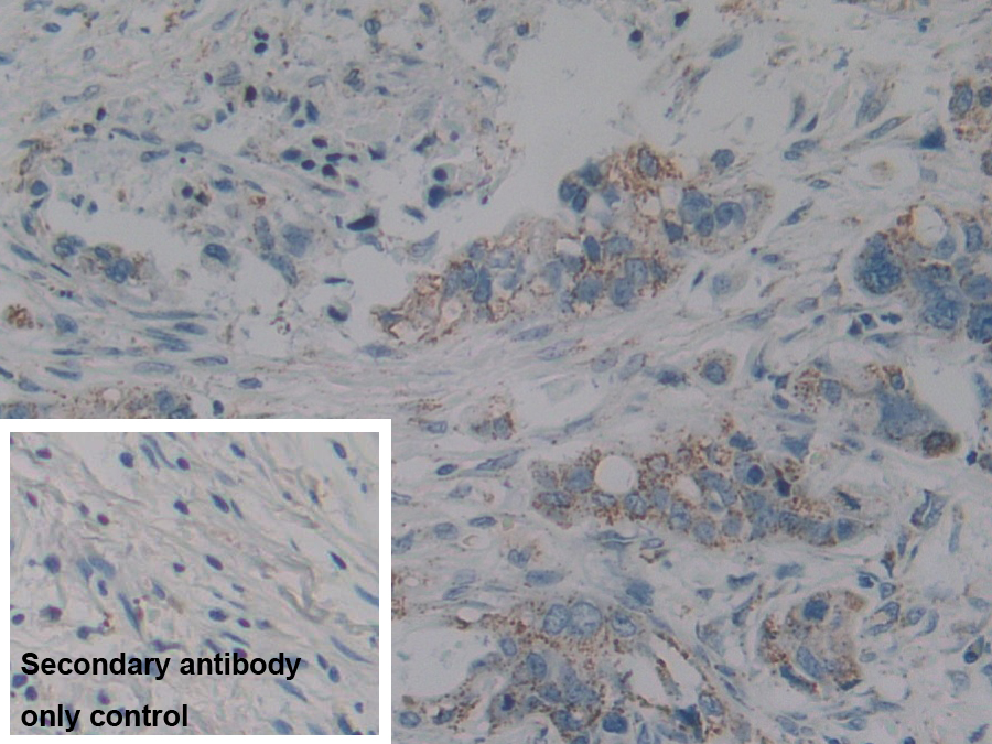 Polyclonal Antibody to Complement component 1 Q subcomponent-binding protein, mitochondrial (C1QBP)