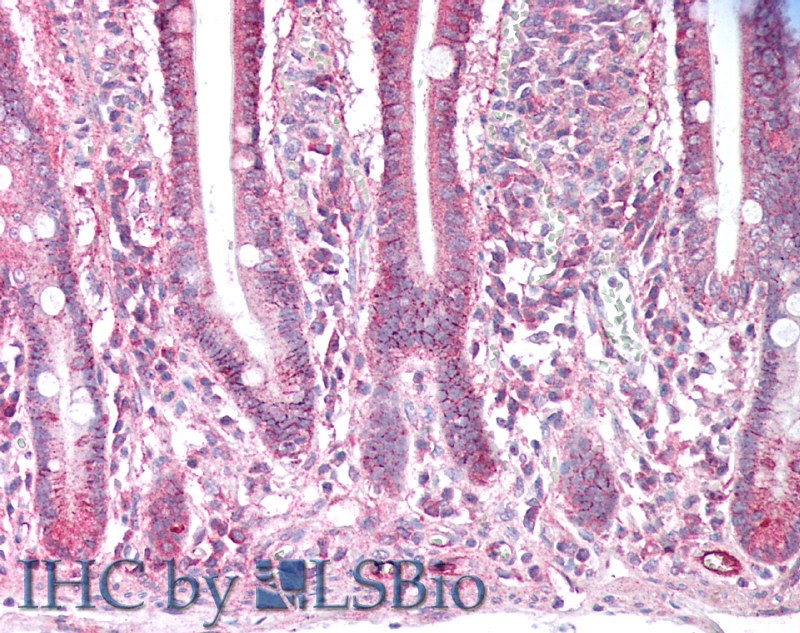 Polyclonal Antibody to Amiloride Binding Protein 1 (ABP1)