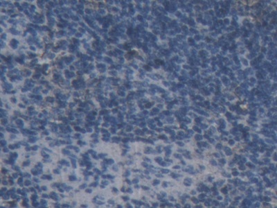 Polyclonal Antibody to Amiloride Binding Protein 1 (ABP1)