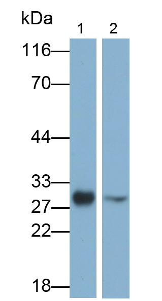 Polyclonal Antibody to Glutathione S Transferase Mu 2 (GSTM2)