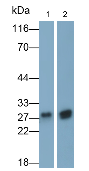 Polyclonal Antibody to Glutathione S Transferase Mu 2 (GSTM2)