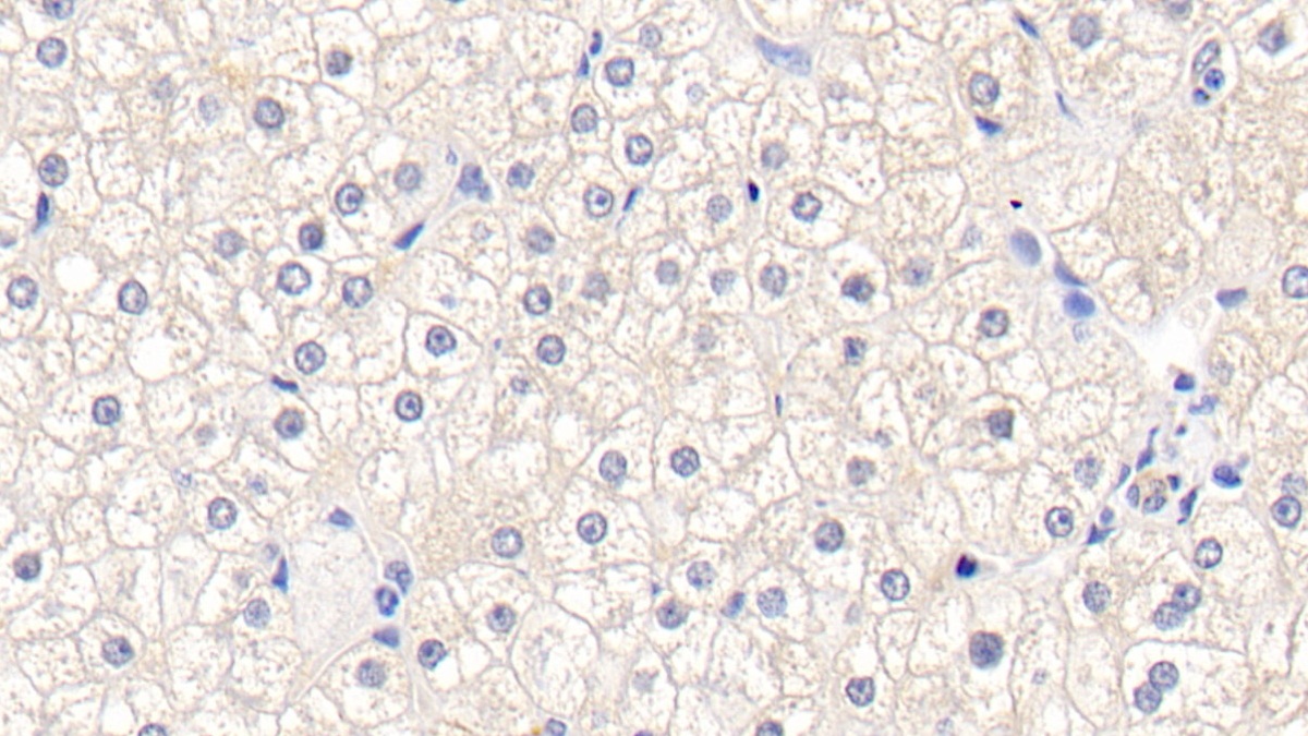 Polyclonal Antibody to Glutathione S Transferase Mu 1 (GSTM1)