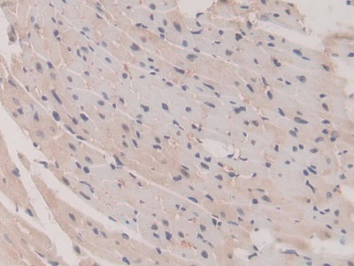 Polyclonal Antibody to Glutathione S Transferase Mu 1 (GSTM1)