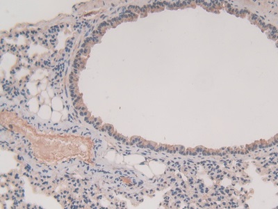 Polyclonal Antibody to Glutathione S Transferase Mu 1 (GSTM1)