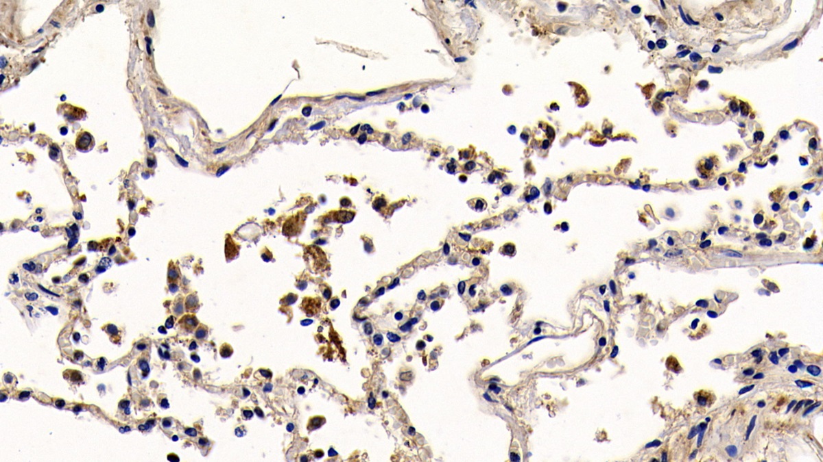 Polyclonal Antibody to Toll Like Receptor 2 (TLR2)