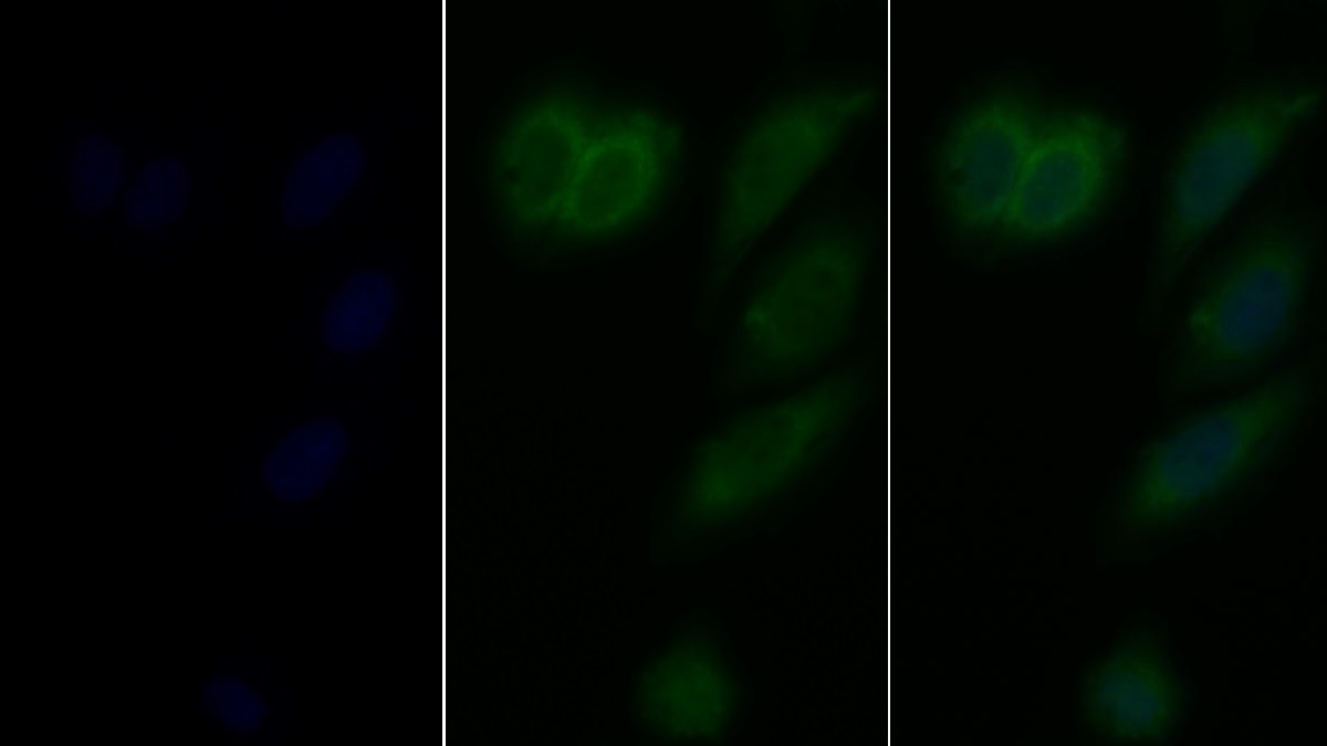 Polyclonal Antibody to Toll Like Receptor 2 (TLR2)