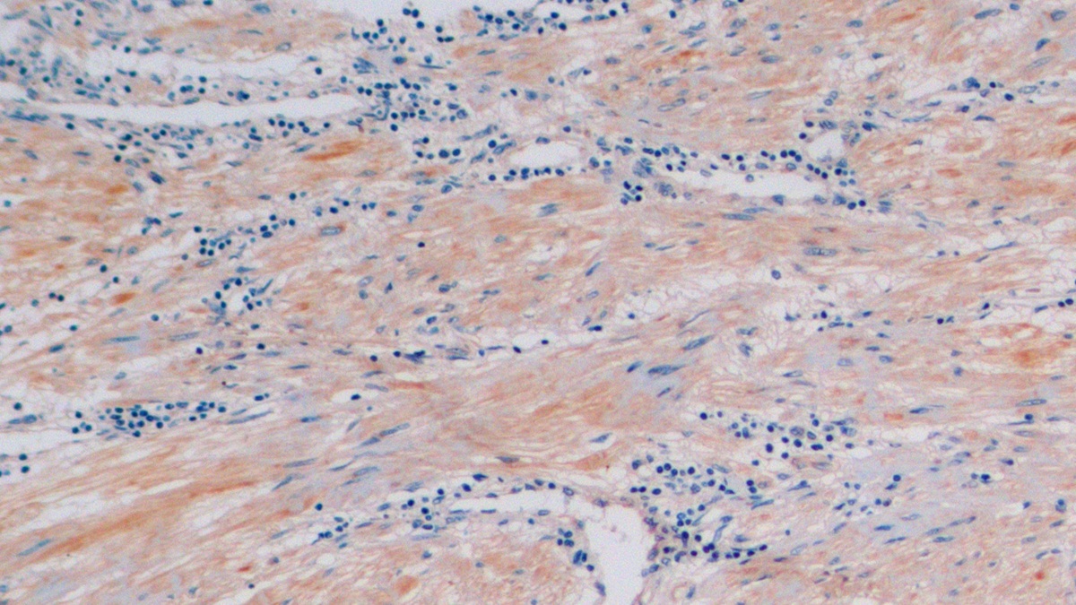 Polyclonal Antibody to Cross Linked C-Telopeptide Of Type I Collagen (CTXI)