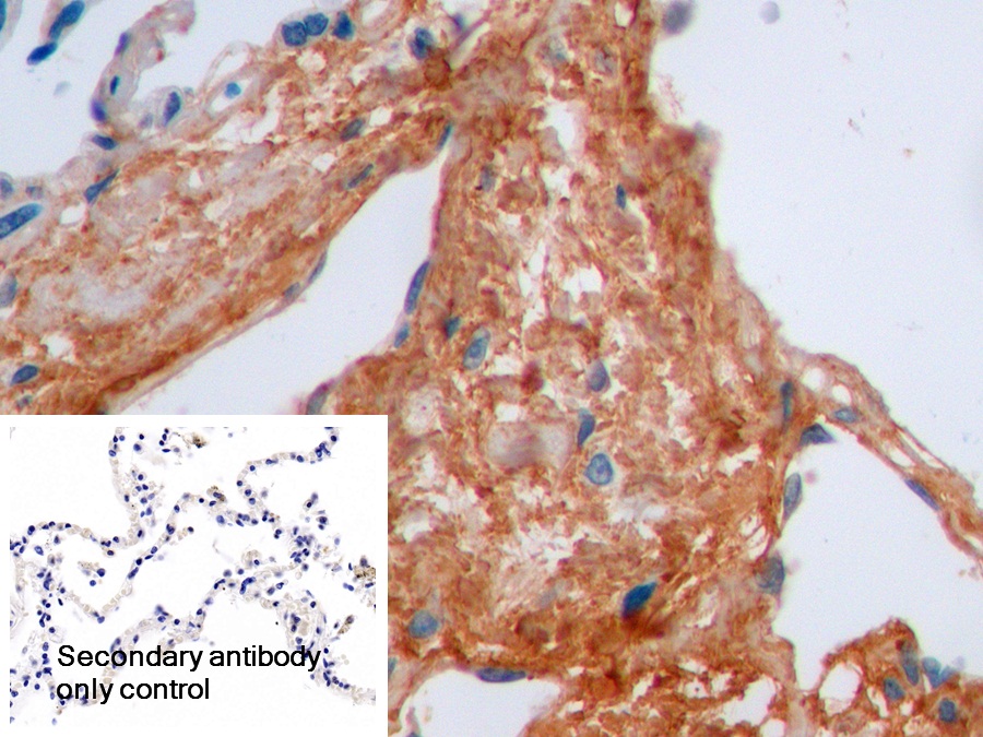 Polyclonal Antibody to Cross Linked C-Telopeptide Of Type I Collagen (CTXI)