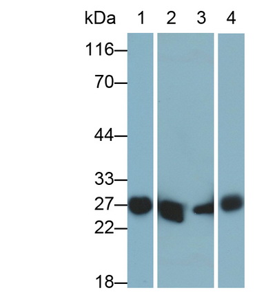 Polyclonal Antibody to Glutathione S Transferase Alpha 3 (GSTa3)