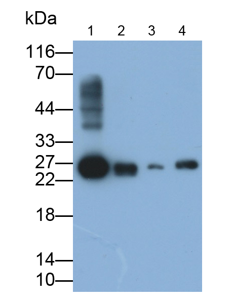 Polyclonal Antibody to Glutathione S Transferase Alpha 3 (GSTa3)