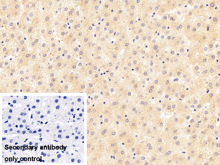 Polyclonal Antibody to Coagulation Factor XII (F12)