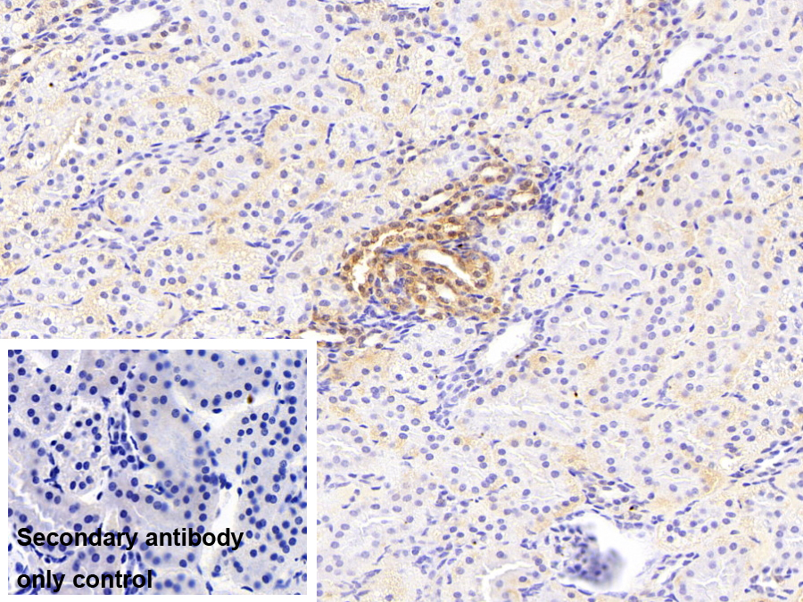 Polyclonal Antibody to Coagulation Factor XII (F12)