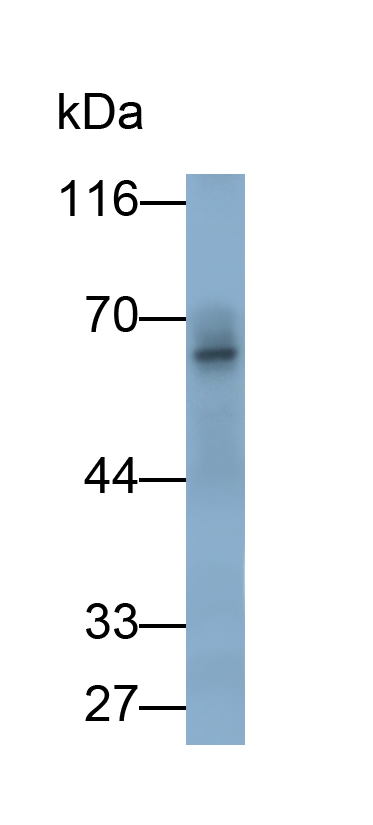 Polyclonal Antibody to Protein Kinase, AMP Activated Alpha 1 (AMPK Alpha 1)