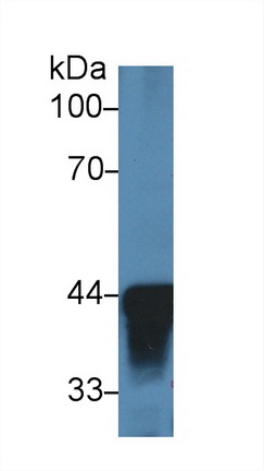 Polyclonal Antibody to Alcohol Dehydrogenase 1 (ADH1)