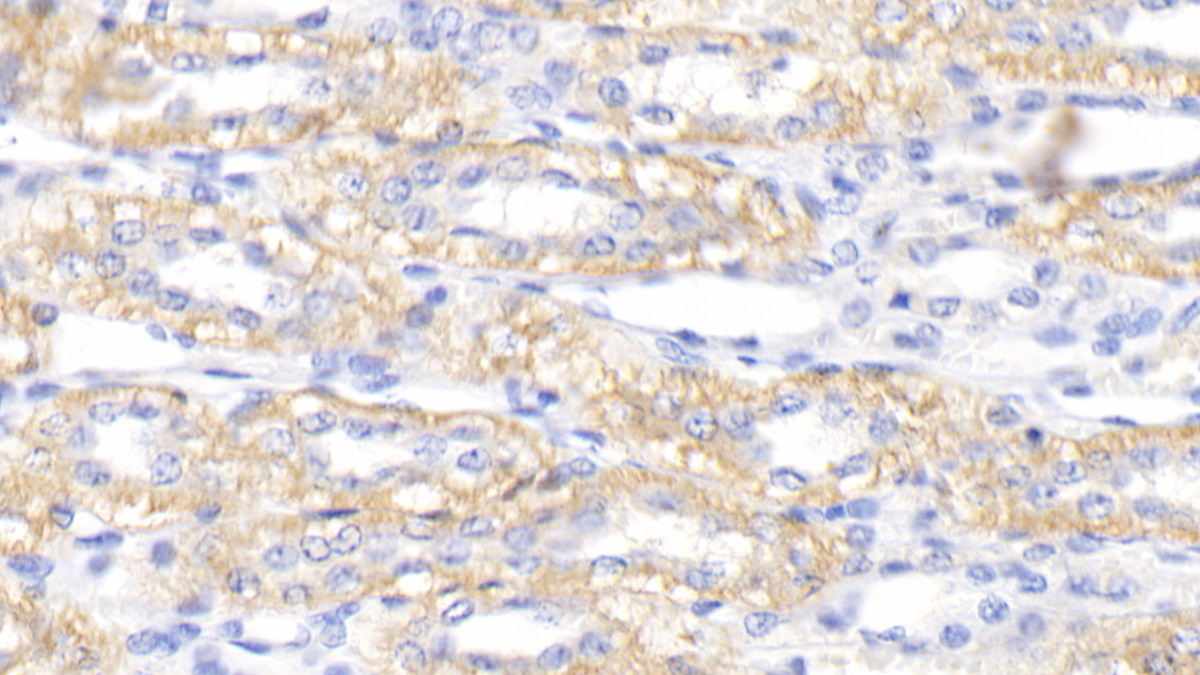 Polyclonal Antibody to Procalcitonin (PCT)