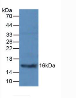 Polyclonal Antibody to Procalcitonin (PCT)