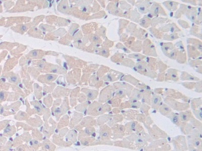 Polyclonal Antibody to Procalcitonin (PCT)