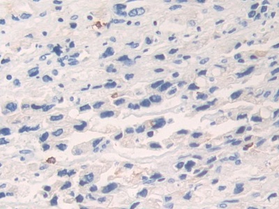 Polyclonal Antibody to Kallikrein 6 (KLK6)