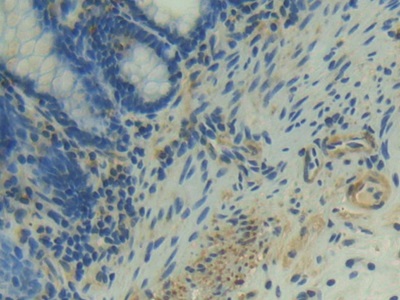 Polyclonal Antibody to Neuropilin 1 (NRP1)