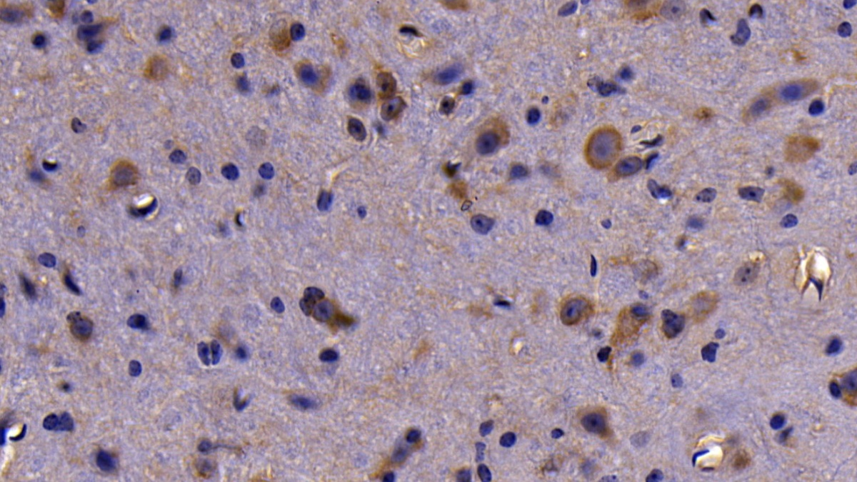 Polyclonal Antibody to Neuropilin 1 (NRP1)