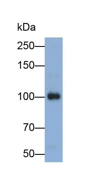 Polyclonal Antibody to Neuropilin 1 (NRP1)