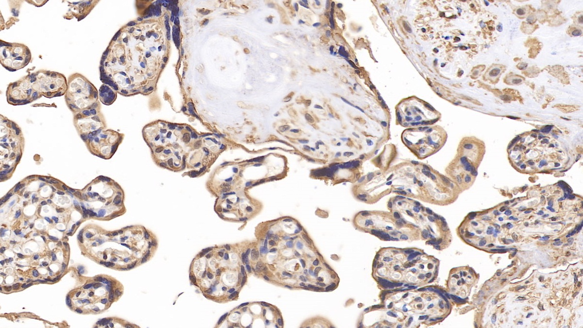 Polyclonal Antibody to Neuropilin 1 (NRP1)