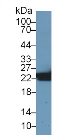 Polyclonal Antibody to Heat Shock Protein 27 (Hsp27)