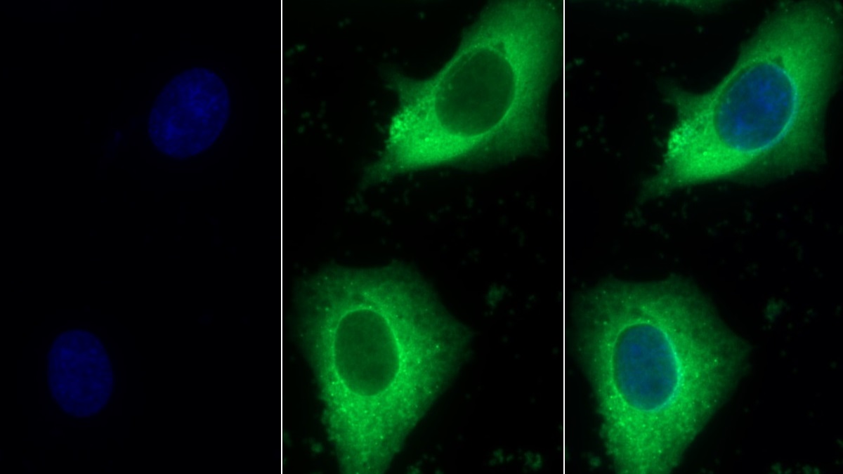 Polyclonal Antibody to Heat Shock Protein 27 (Hsp27)