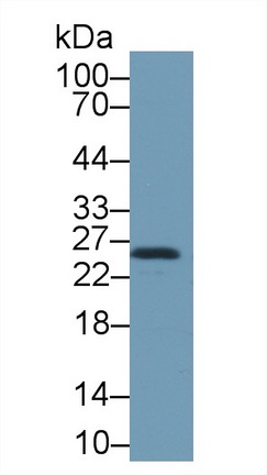 Polyclonal Antibody to Heat Shock Protein 27 (Hsp27)