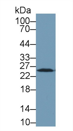 Polyclonal Antibody to Heat Shock Protein 27 (Hsp27)