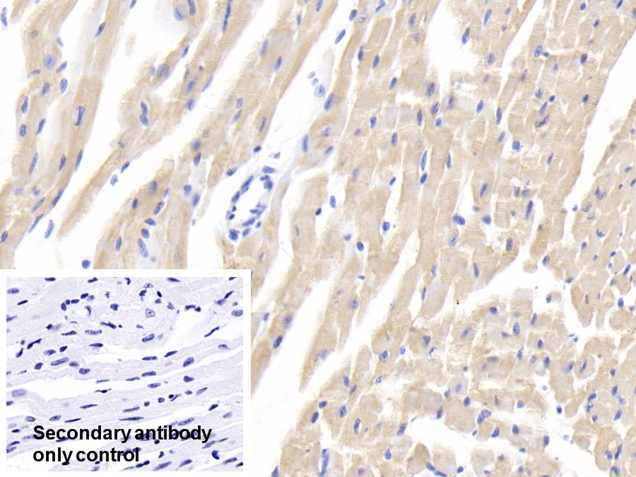 Polyclonal Antibody to Heat Shock Protein 27 (Hsp27)