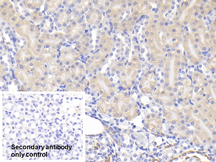 Polyclonal Antibody to Heat Shock Protein 27 (Hsp27)