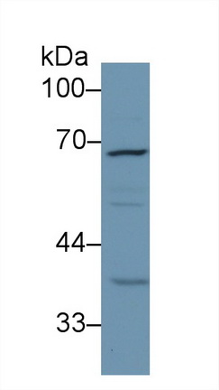 Polyclonal Antibody to Dihydrolipoyl Transacetylase (DLAT)