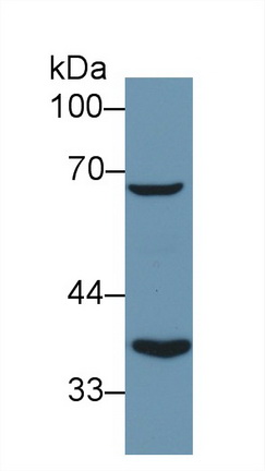 Polyclonal Antibody to Dihydrolipoyl Transacetylase (DLAT)