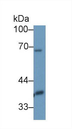 Polyclonal Antibody to Dihydrolipoyl Transacetylase (DLAT)