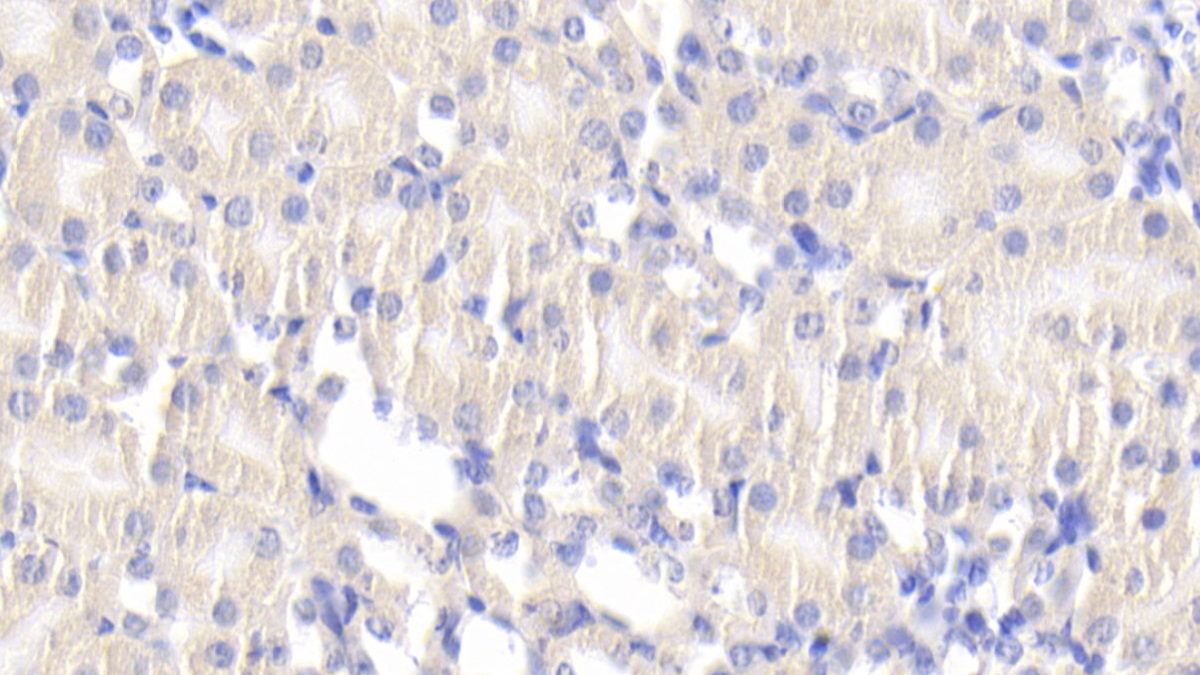 Polyclonal Antibody to Dihydrolipoyl Transacetylase (DLAT)