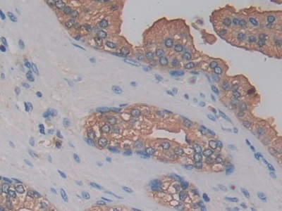 Polyclonal Antibody to Kallikrein 10 (KLK10)